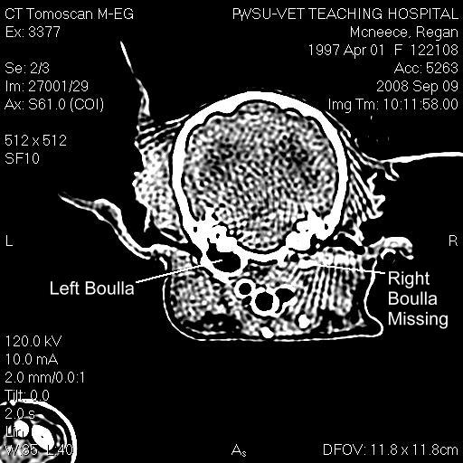 CT Scan